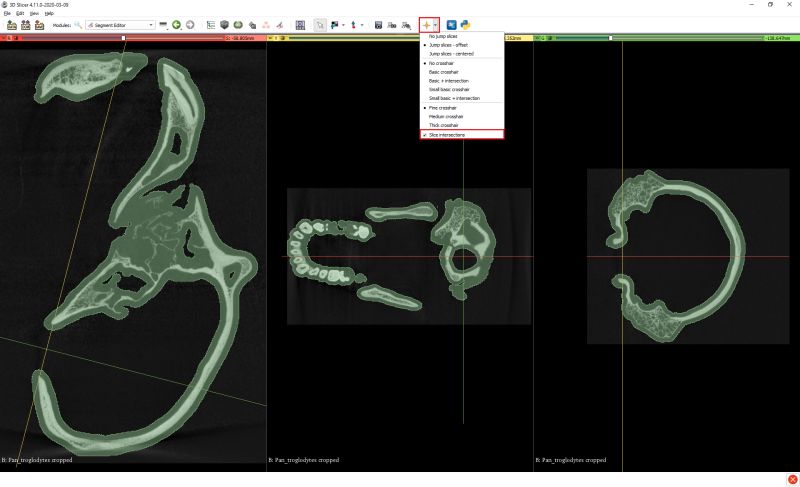 Cavity Segmentation Creating Endocasts Slicermorph Github Io - 4K Light Wallpapers for Desktop