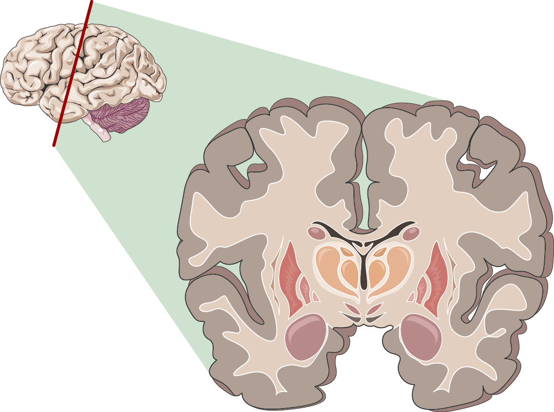 Brain sections