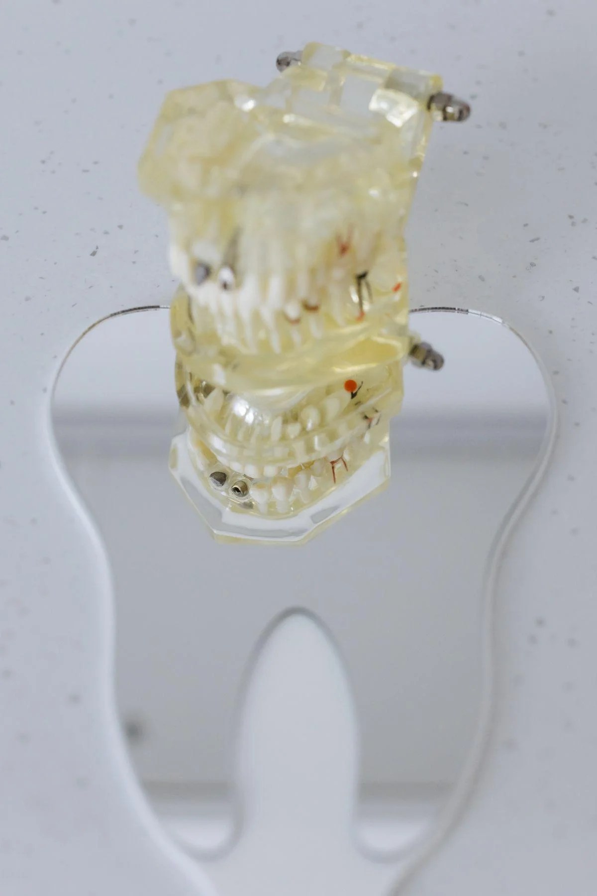 Bleeding Gums When You Brush: Early Gum Disease Signs Concord Patients Should Not Ignore