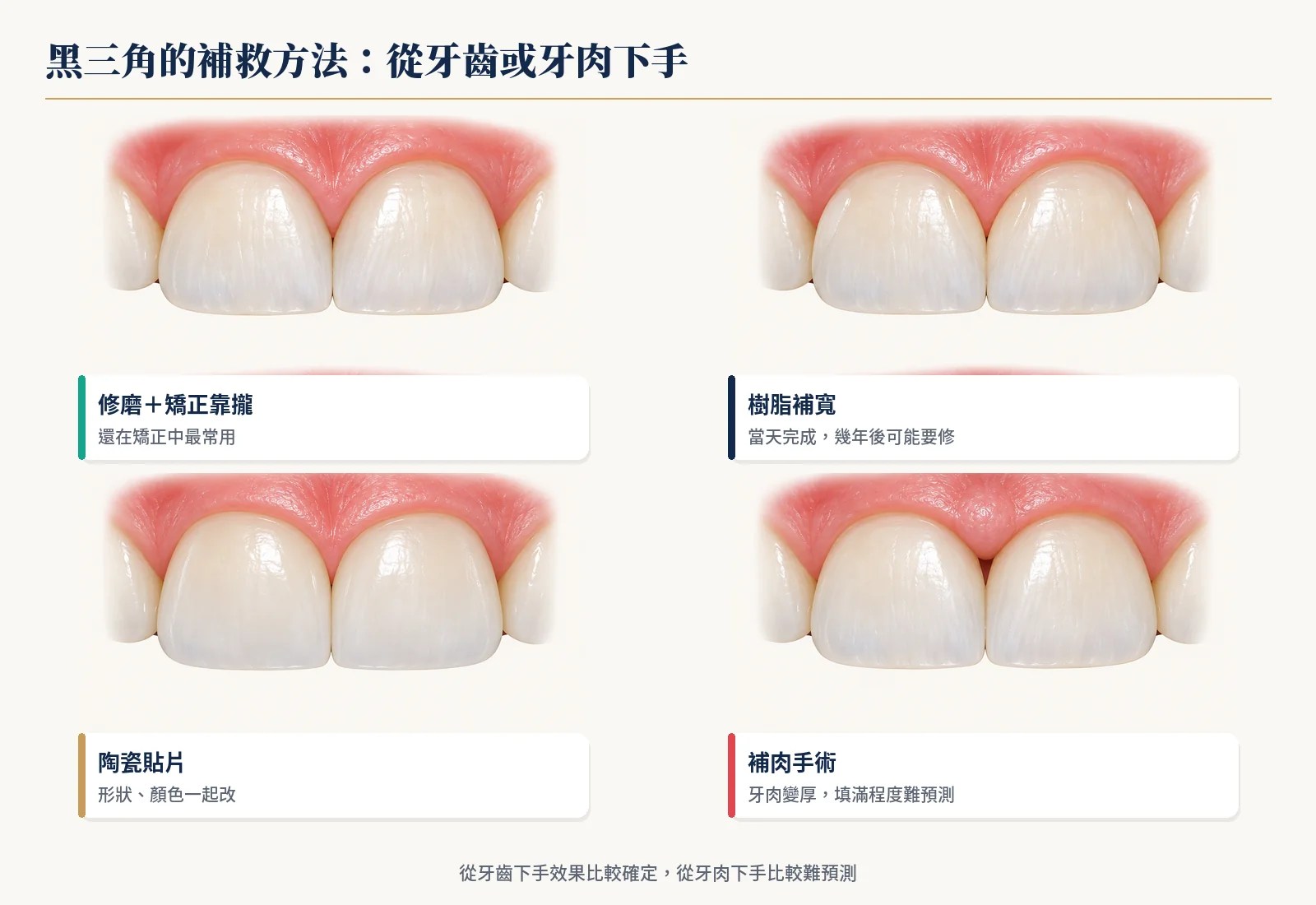 黑三角四種補救方法：修磨靠攏、樹脂補寬、陶瓷貼片、補肉手術
