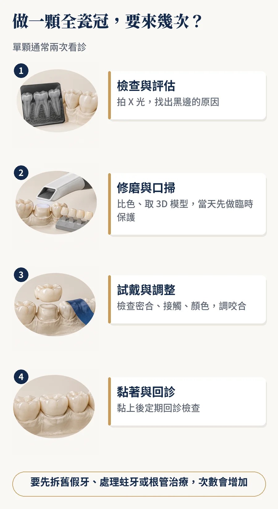 做一顆全瓷冠的流程：檢查評估、修磨口掃、試戴調整、黏著回診