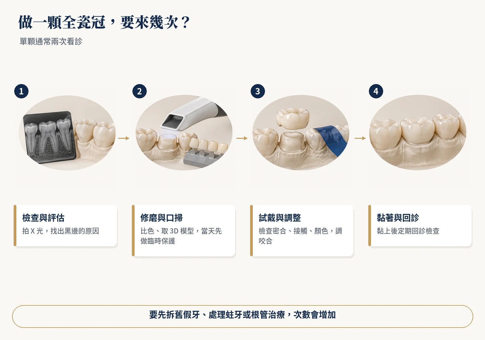 做一顆全瓷冠的流程：檢查評估、修磨口掃、試戴調整、黏著回診