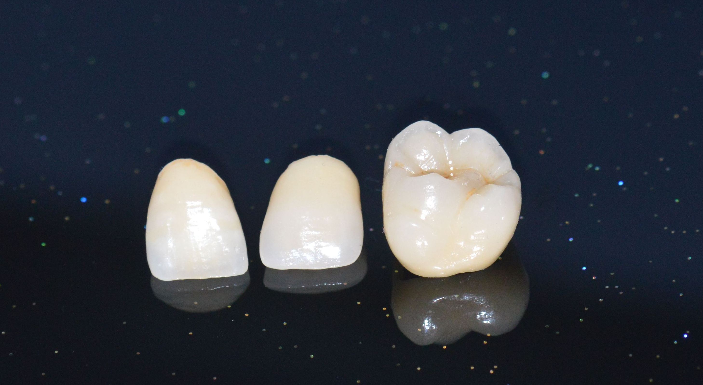 ästhetische Digitale Zahnmedizin