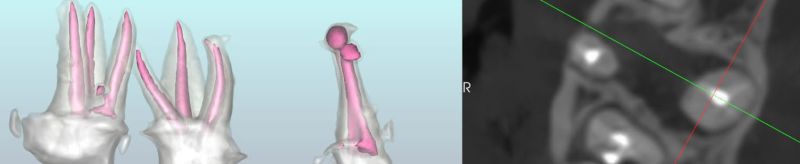 Github Geraldoslo Endodonticmeasurements - Premium Dark Picture Gallery - Retina