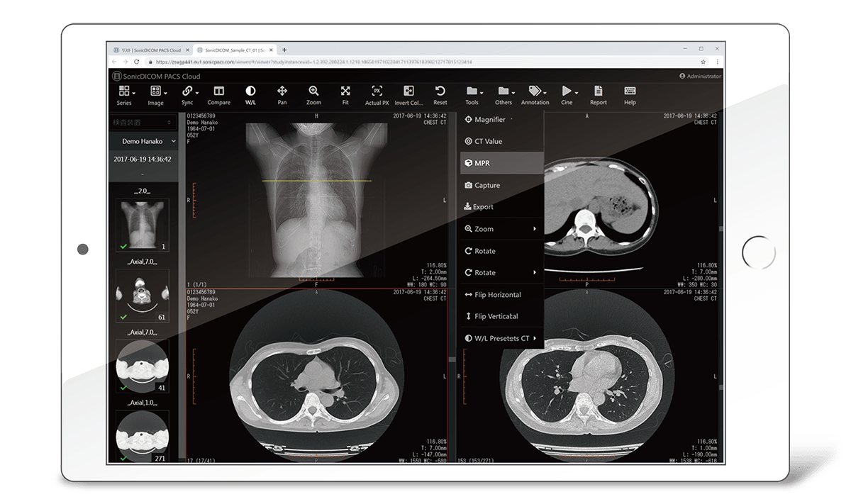 Microdicom is a free dicom viewer software which lets you view single and multiple dicom files. Dicom Viewer Dicom Server Sonicdicom