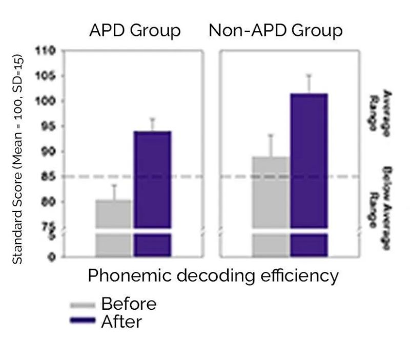 Fast Forword Auditory Processing Research Sonic Learning - Premium Light Pattern Gallery - High Resolution