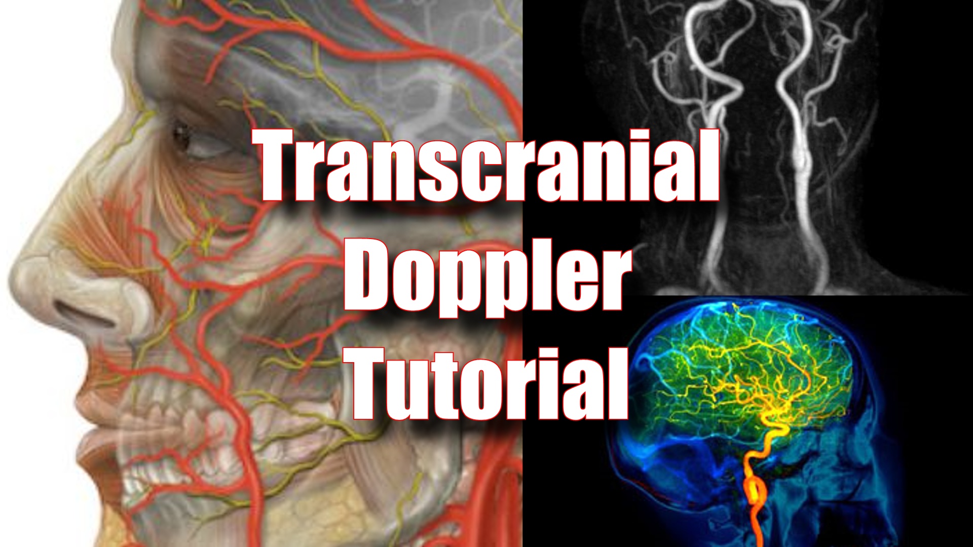 Transcranial Doppler – Sonographic Tendencies