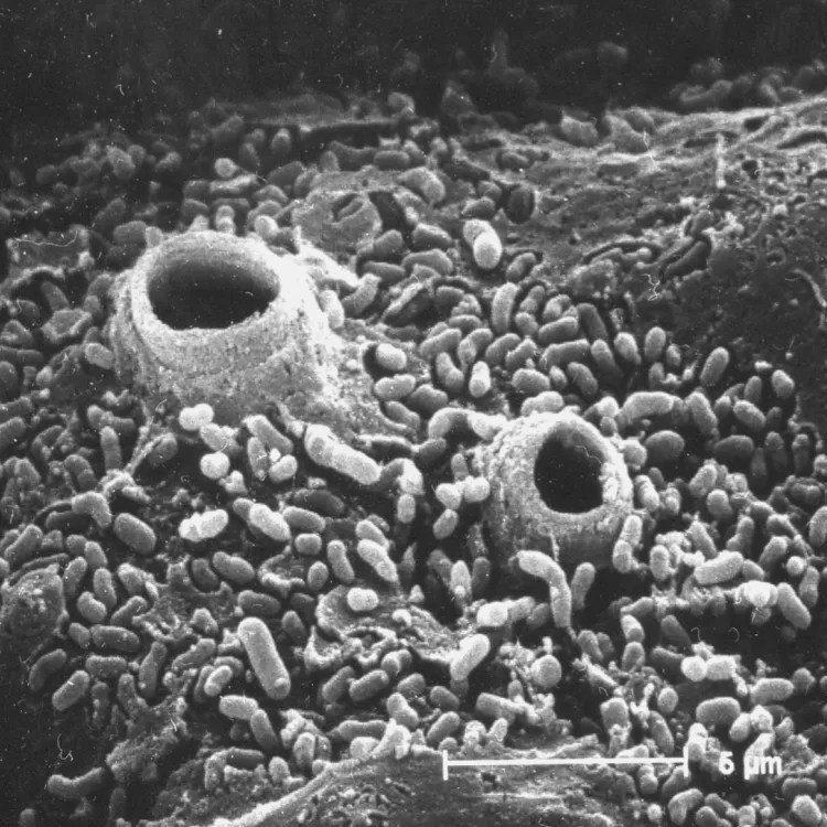 Micrografía electrónica del hongo quitridio sobre tejido de anfibio