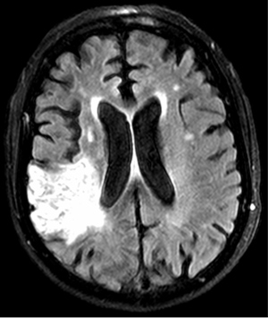 Visit the barnes jewish hospital foundation website today for more info! Stroke patients benefit from carmakerâs efficiency | The