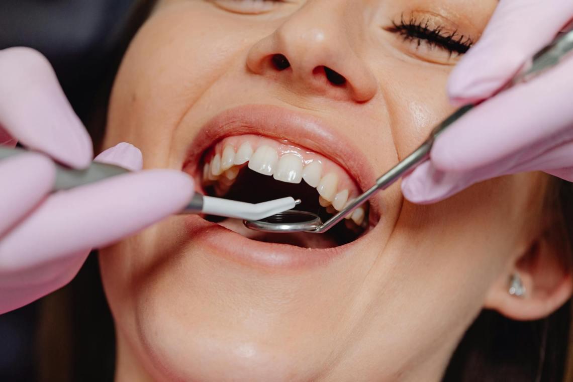 opened mouth woman during dental treatment