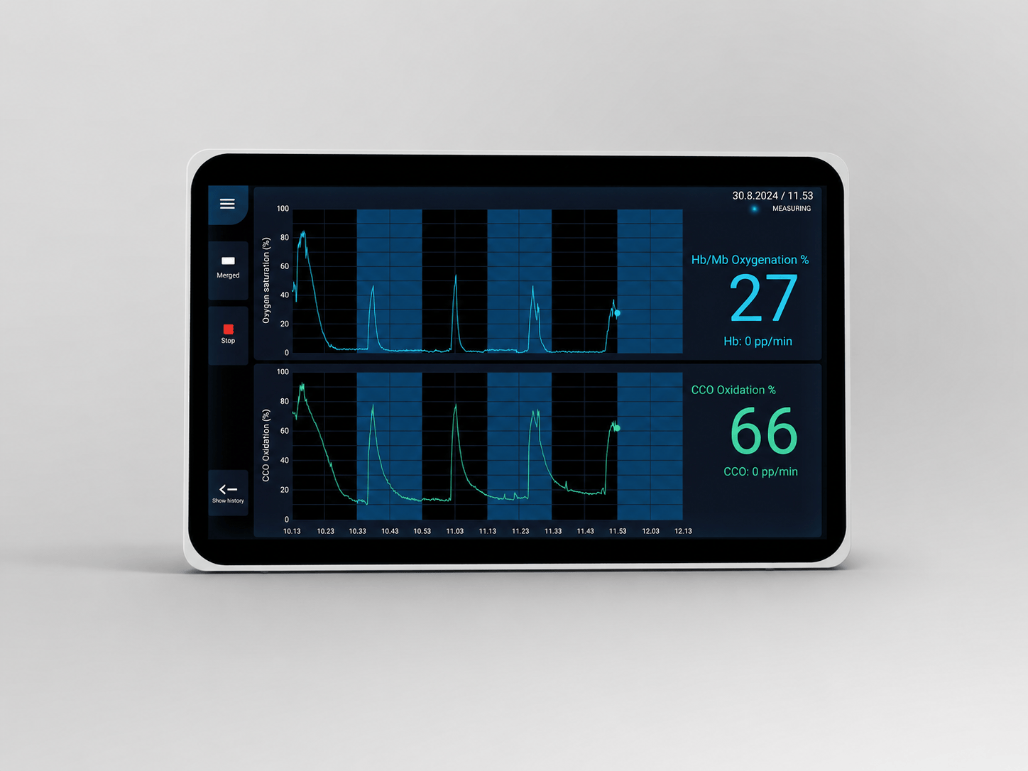SpectroCor Monitor