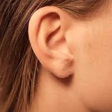 Your ears are part of the SSP treatment