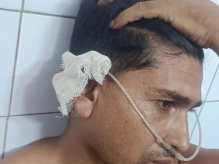 হামিদপুরে গৃহশিক্ষককে কুপিয়ে  জখম!