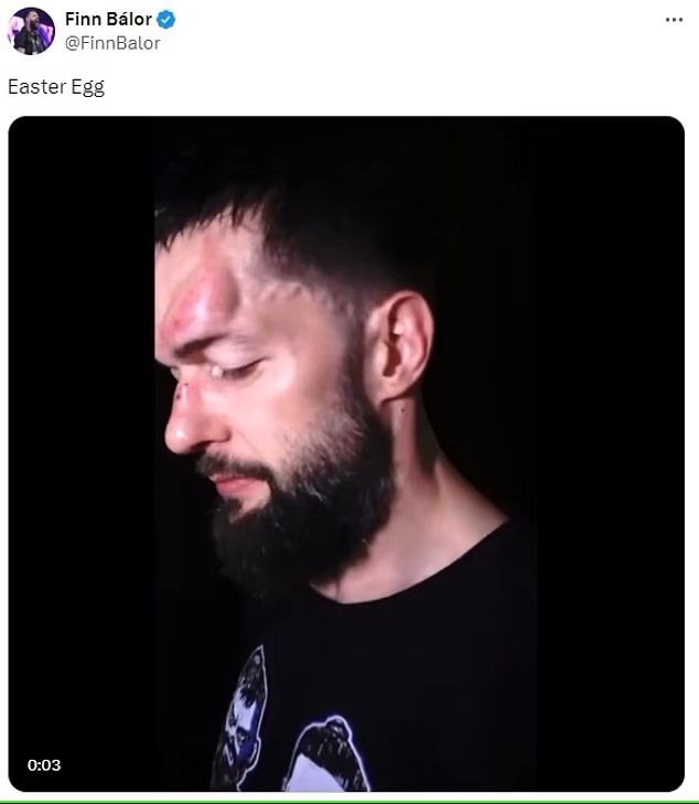 Balor in freak injury before WrestleMania
