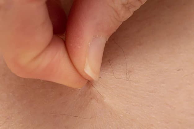 dermatofibroma