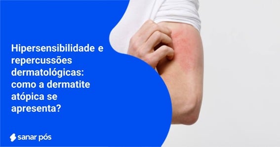 dermatite atópica
