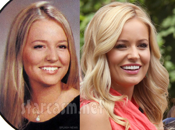 Photos Did Emily Maynard Have Plastic Surgery? * Starcasm.net