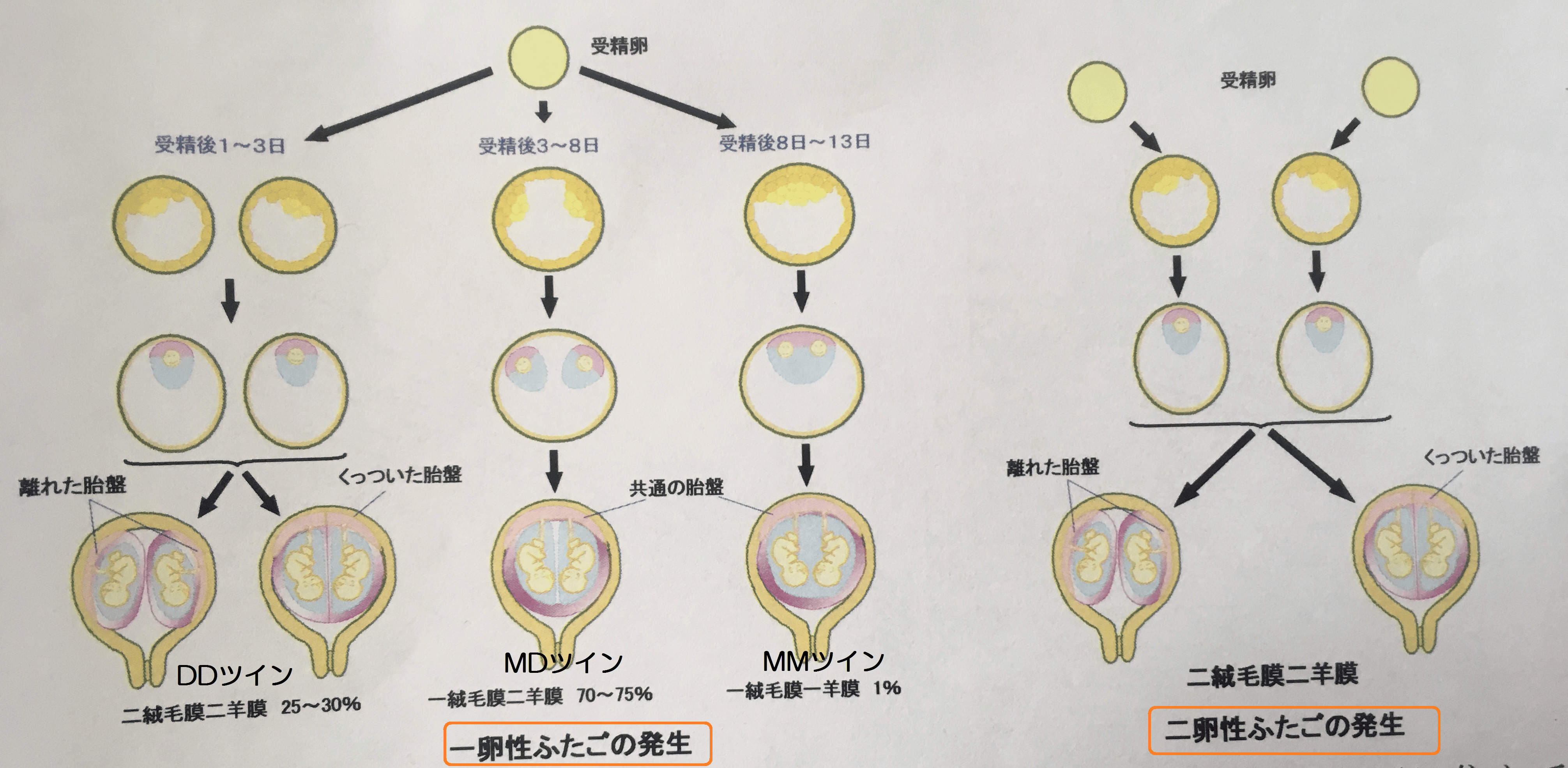 一卵性・二卵性だけじゃない！？妊娠中に双子の種類を知る重要性