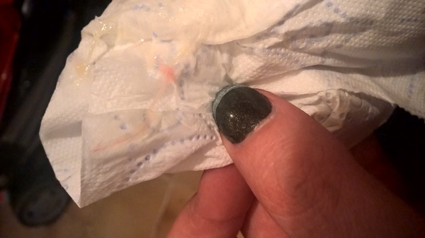 Ik heb al een paar dagen heel waterige afscheiding. Nod Maart 2016 Pagina 37 Zwanger Worden Forum