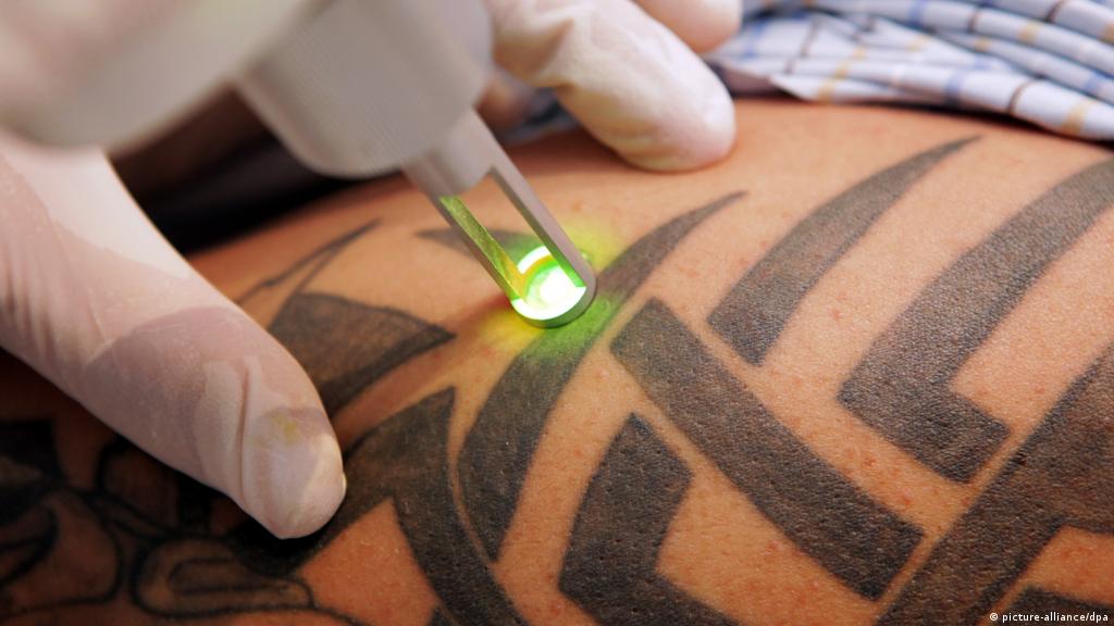 Canada ja vende creme remover tatuagem Canadense Cria Creme Capaz De Remover Tatuagens Sem Dor Pequenas Empresas Grandes Negocios Estetica E Bem Estar