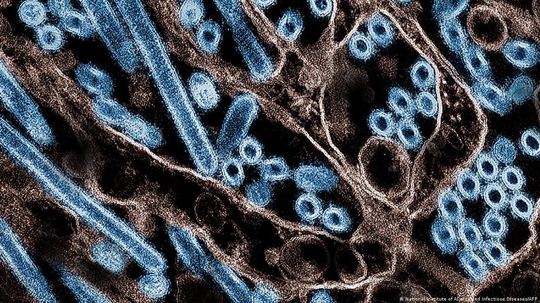 Imagen microscópica de particulas de gripe aviar. 