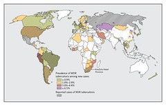 XDR TB in World (by qjhouse)