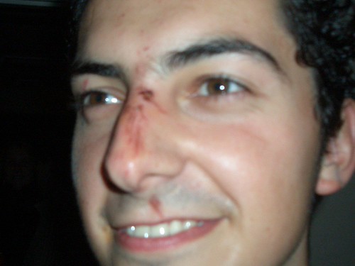 Primer plano del desastre