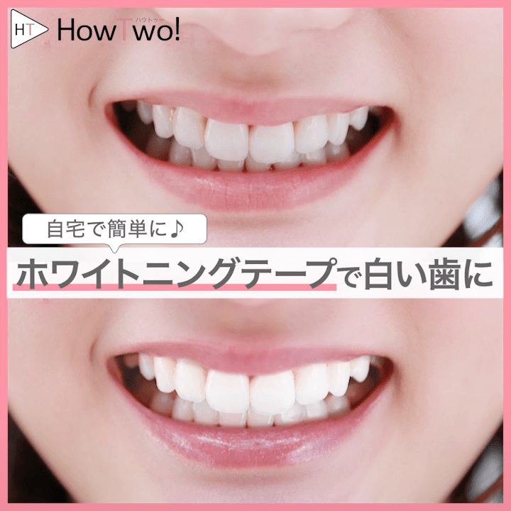 クレスト ホワイトニング テープ 使い方 貼るだけで輝く白い歯に ホワイトニングテープの効果 Gxplu