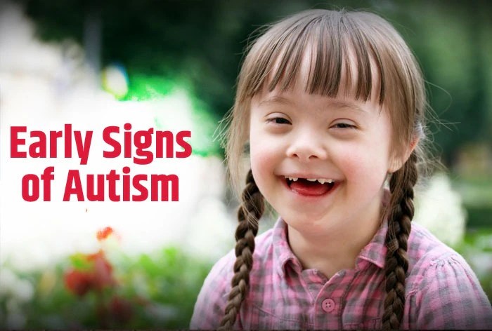 Autism spectrum disorder (asd): how to know if your child has autism