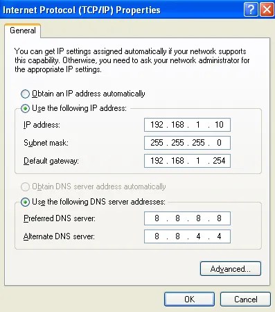 windows xp tcp/ip settings