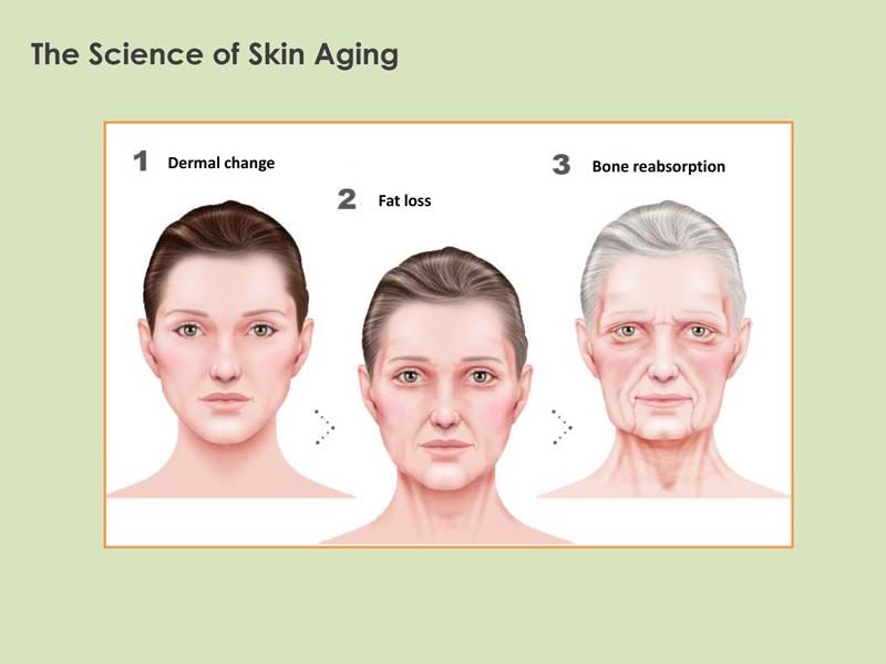 การผ่าตัดเปลี่ยนโครงหน้า