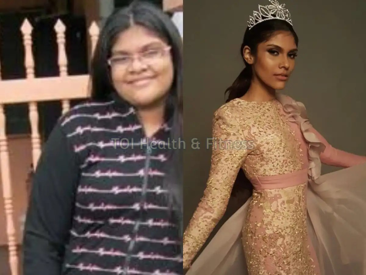 Weight Loss Story This Girl Lost 51 Kilos In Just 6 Months And Became A Model Her Transformation Is Jaw Dropping Times Of India