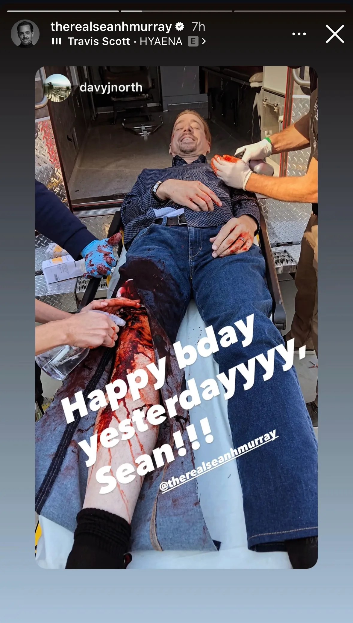 Tim McGee Is Bloodied In Newly-Launched NCIS Set Picture To Have a good time Sean Murray’s Birthday