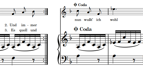 In sheet music, this sign is used to enclose certain parts that are to be played more than once by the use of double bar lines and dots. Repeat Markers