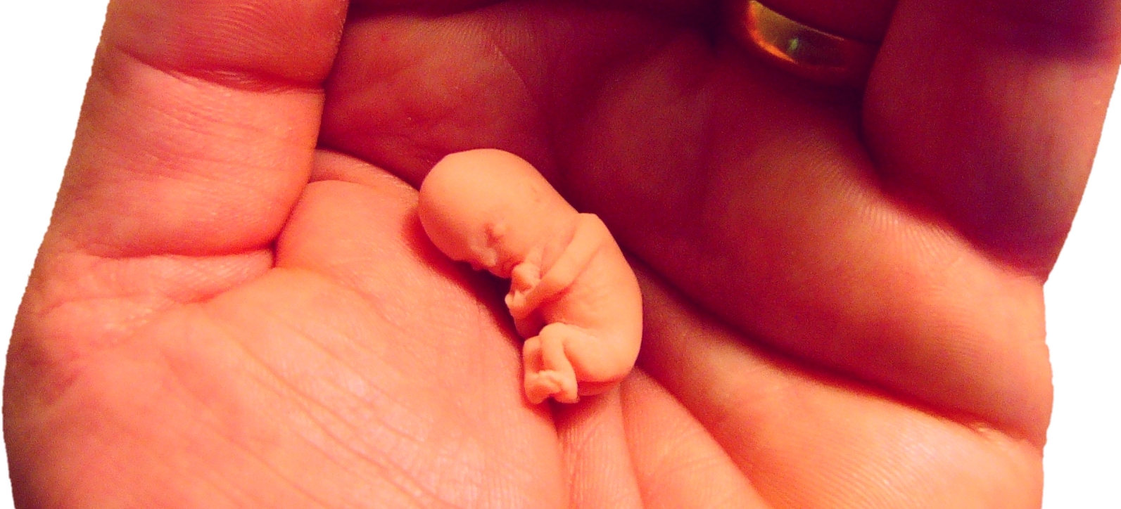 Jog az abortuszhoz – nem létezik