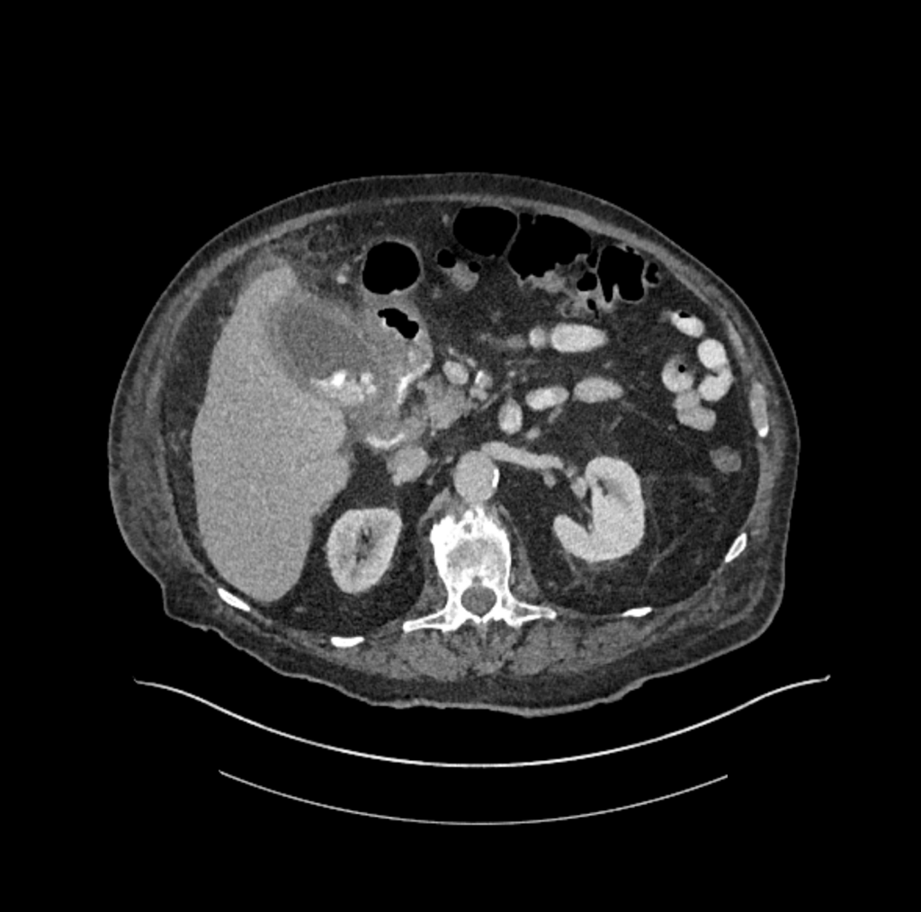 CT Case 059 01