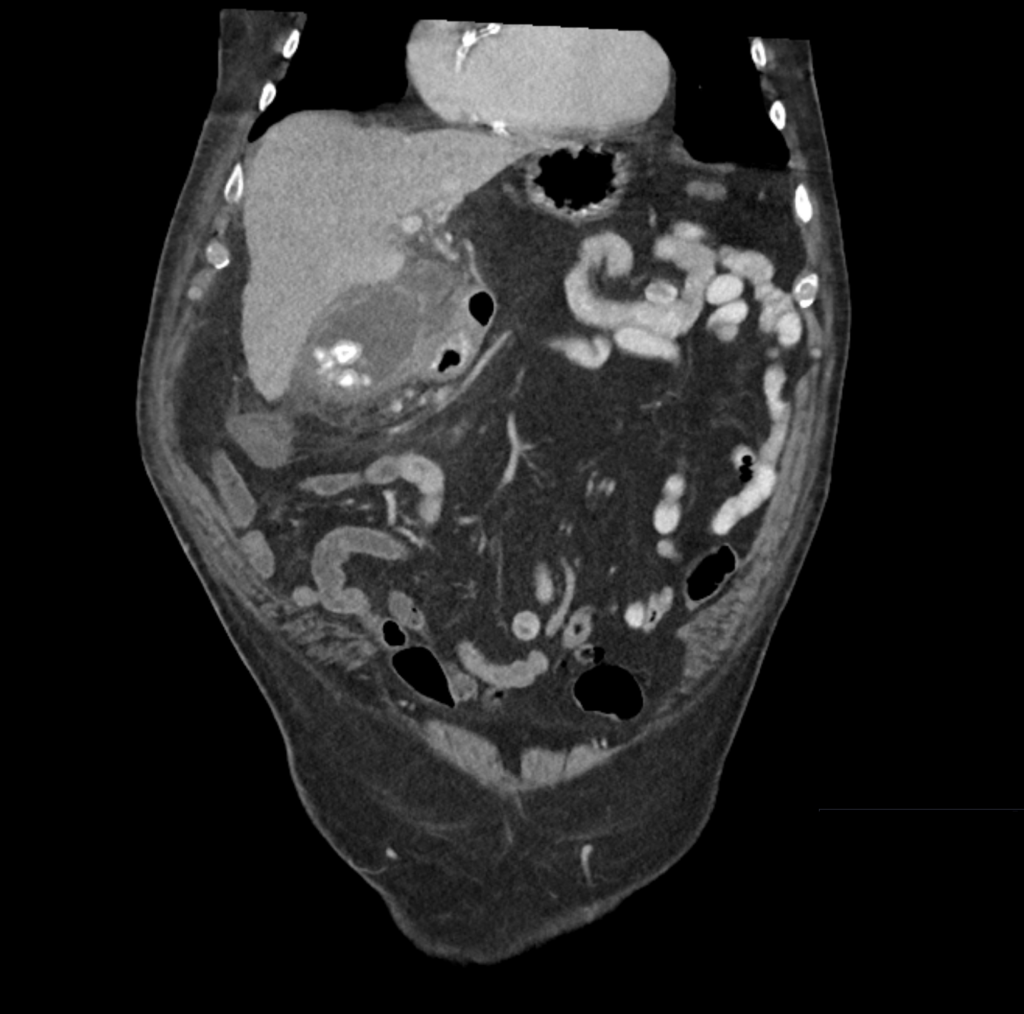 CT Case 059 02