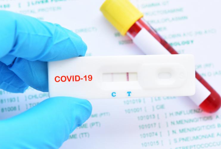 Test-Antigenique-Coronavirus-Covid-19-1.jpeg