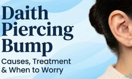 Daith Piercing Bump: Causes, Treatment & When to Worry