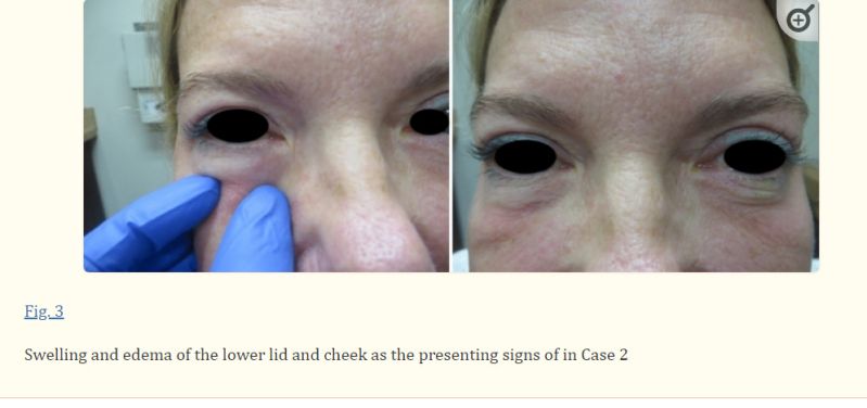 E 19 S Cutaneous - Best Dark Patterns in Full HD