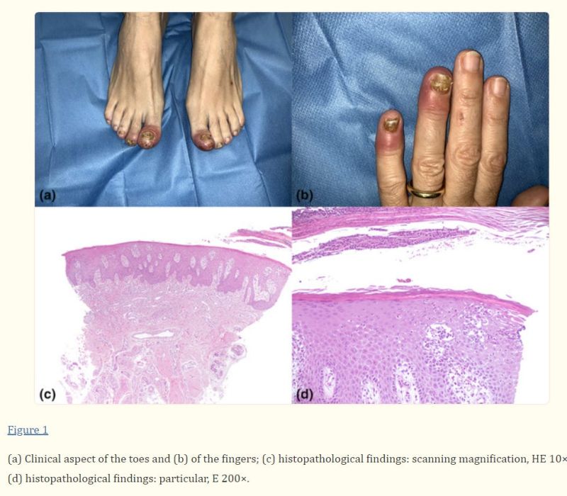 E 19 S Cutaneous - Full HD Minimal Images for Desktop