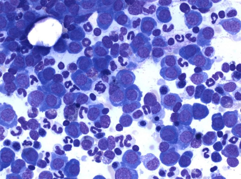 Demystifying Bone Marrow Evaluation - High Resolution Gradient Images for Desktop