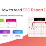 How To Read ECG Report?