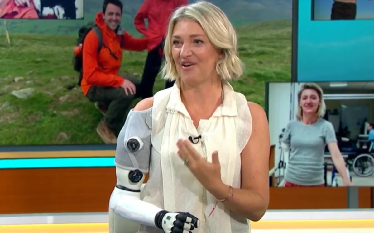 Mind-Reading Bionic Arm: How This British Woman Became 80% Human, 20% Robot (2026)
