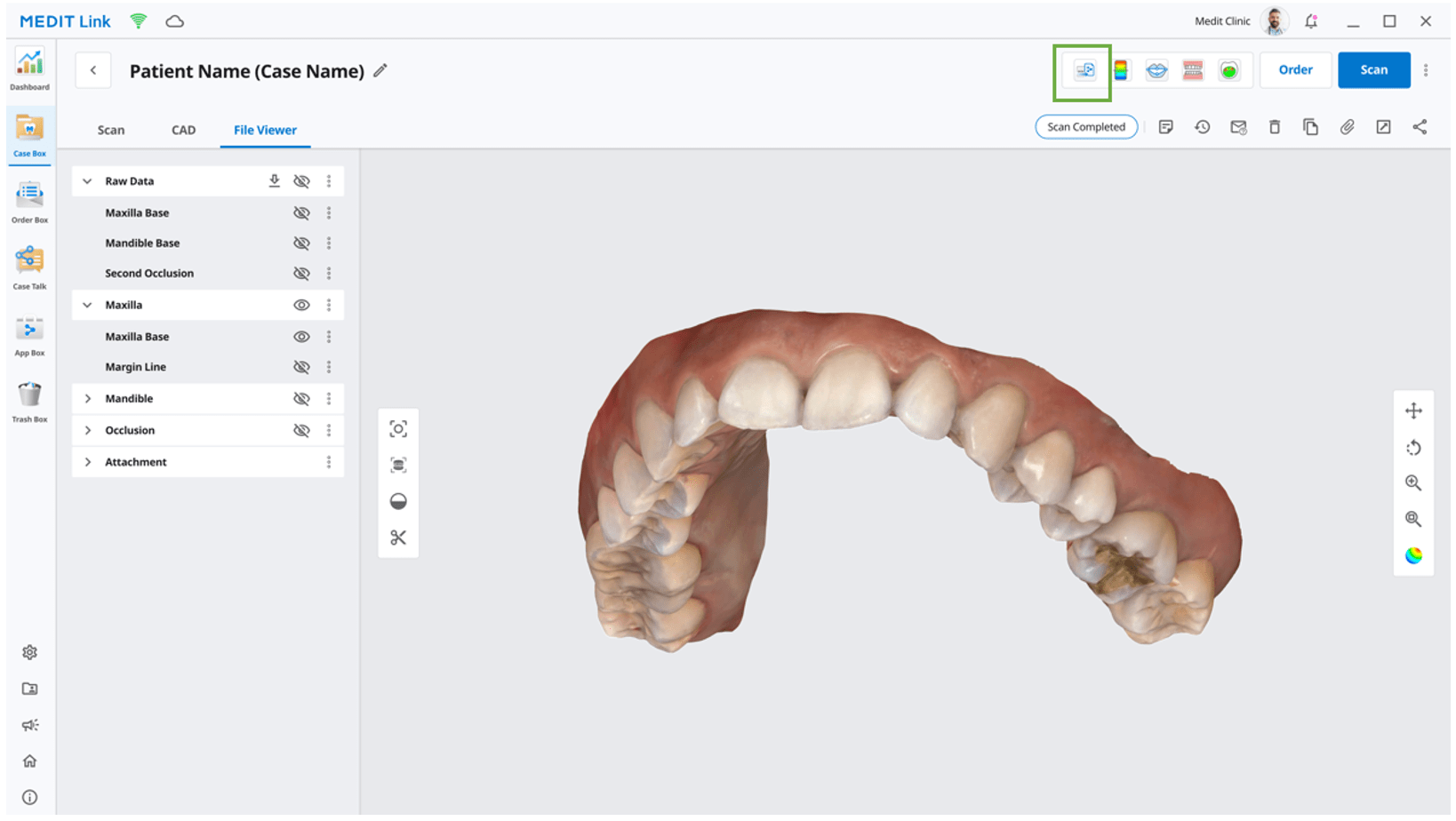 How to use medit dcm converter