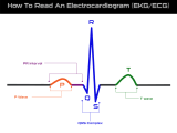 How To Read An Electrocardiogram Ekg Ecg Surefire Cpr
