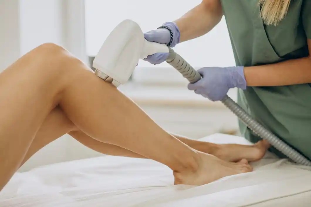 Epilation laser solution moderne efficace