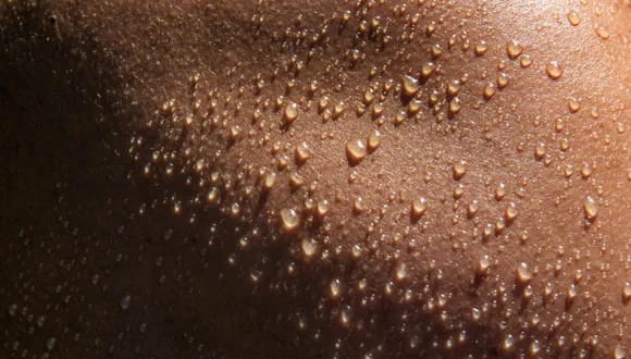 Excessive Sweat, Sweating, Swamp Butt