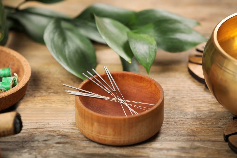 History & Facts About Acupuncture Chinese Traditional Medicine