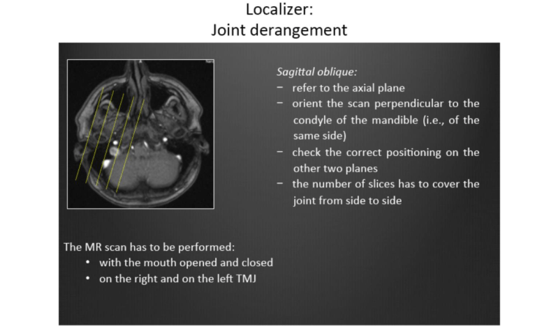 Tmj Protocol Skadekompassen - Retina Light Images for Desktop
